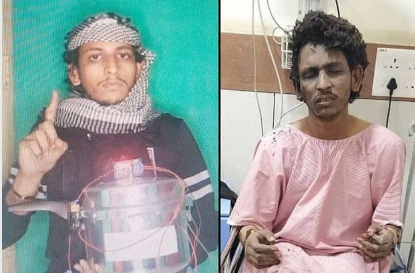 ಮಂಗಳೂರು ಕುಕ್ಕರ್ ಬಾಂಬ್ ಸ್ಫೋಟ: ಅಪರಾಧ ಒಪ್ಪಿಕೊಂಡ ಶಂಕಿತ ಉಗ್ರ ಶಾರೀಕ್