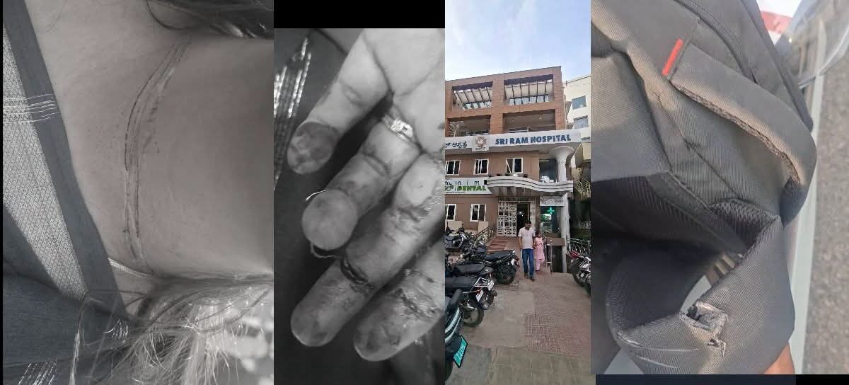 ಕೆಆರ್ ಪುರಂ ಬಳಿ ಚೈನೀಸ್ ಮಾಂಜಾದಿಂದ ಭೀಕರ ಅಪಘಾತ: ಮಹಿಳೆಗೆ ಗಂಭೀರ ಗಾಯ, ಪ್ರಾಣಾಪಾಯದಿಂದ ಪಾರು!